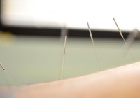 Acupuncture : une solution efficace pour la santé
